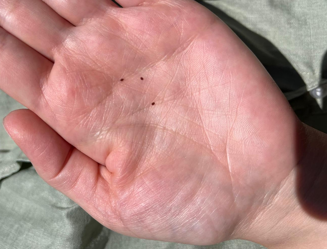 3 bird mites on palm of hand