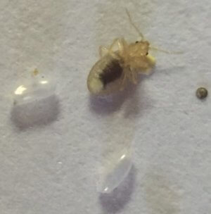 baby bed bugs and eggs