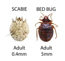Scabies vs Bed Bugs