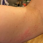 Arm