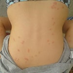 On Back