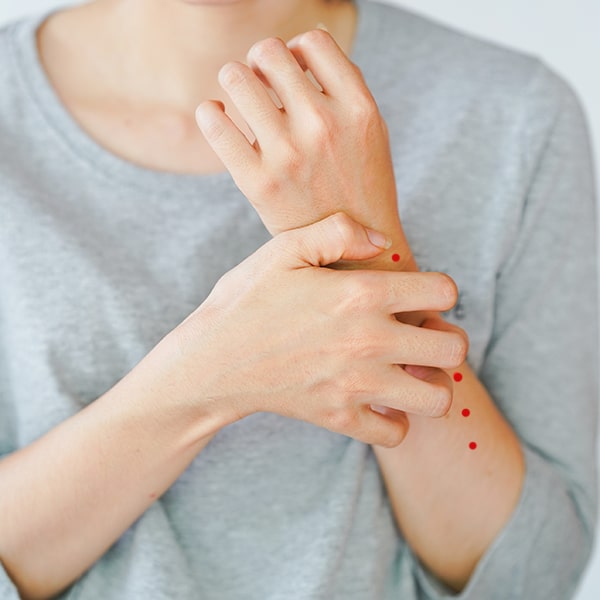 Dont scratch bed bug bites