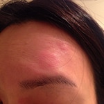 Forehead