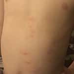 Stomach