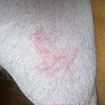 Upper Leg